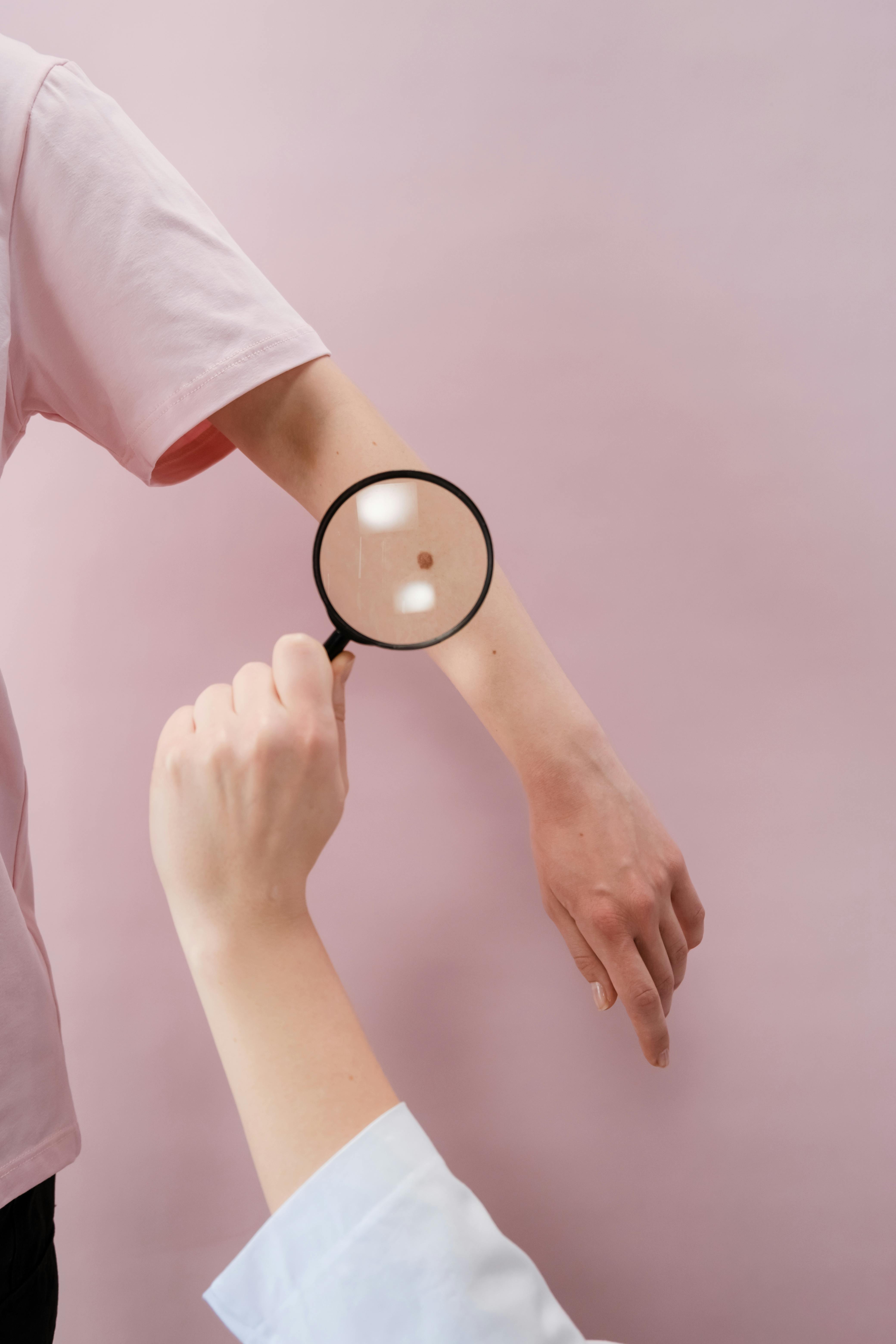 Dermatoskopija i trihoskopija